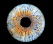 Computer-enhanced blue/grey iris of the eye