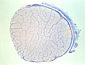 LM of cross section of human optic nerve