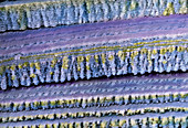 False-colour SEM of cells from the lens of the eye