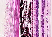 Light micrograph of a section through the eye wall
