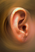 Swirling effect around ear pinna of a child