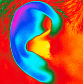 Thermogram of a close-up of a human ear