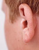 Boy's ear