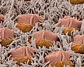 Foetal inner ear hair cells,SEM