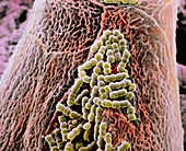 False-colour SEM of filiform papilla with bacteria