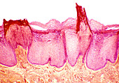 Tongue papillae,light micrograph