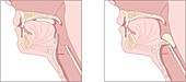 Mechanics of swallowing,diagram