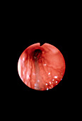 Endoscope image of normal fundus of stomach