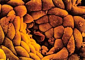 Coloured SEM of the stomach mucosa & gastric pit