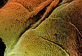 Coloured SEM of epithelial cells in the oesophagus
