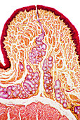 Oesophagus wall,light micrograph