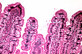 LM of a section through tips of intestinal villi