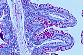 Intestinal villi