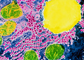 False-colour TEM of a section through a liver cell