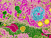 False-colour TEM of human liver showing hepatocyte