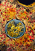SEM of a liver cell hepatocyte