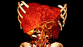 Liver,CT scan