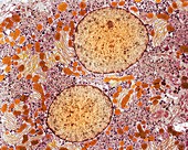 Liver cell,TEM