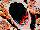 Coloured SEM a small vein in pancreatic tissue