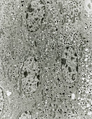TEM of a section of islet of Langerhans cells
