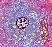Pancreas cell,TEM