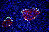 Pancreatic cells,fluorescent micrograph