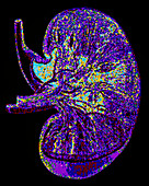 Computer graphic image of a normal human kidney