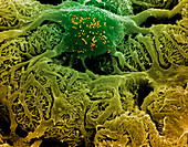 Coloured SEM of podocytes in the human kidney