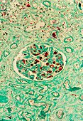 Kidney glomerulus