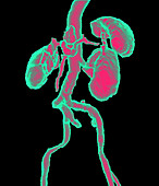 Human kidneys and spleen