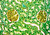 Kidney glomeruli,light micrograph