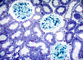 Kidney glomeruli,light micrograph