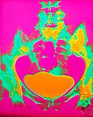 Coloured urogram of a healthy human bladder