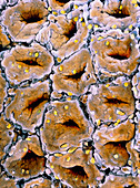 False-colour SEM of glandular mucosa of colon