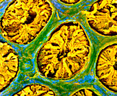 False-colour SEM of glandular wall of the colon