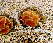 False-colour SEM of goblet cells on wall of colon