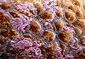 False-colour SEM of wall of colon,with bacteria