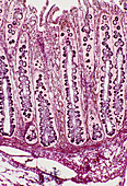 Intestinal villi,light micrograph