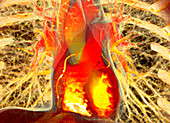 Heart and lungs,CT scan