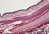 LM of a longitudinal section of a bronchus