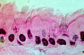 Lung cells,light micrograph