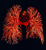 Resin cast of the airways & arteries of the lungs