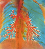 Bronchial tree of lung