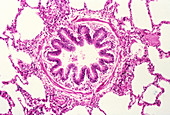 LM of a cross-section of a bronchiole & alveoli
