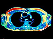 NMR image of axial section through human chest