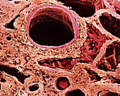 Col SEM of lung,alveolar details & blood clot