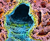 Coloured SEM of lung showing alveoli and vessels