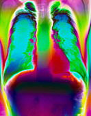 Coloured chest X-ray of a healthy man