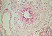 LM of a cross section through a bronchiole in lung