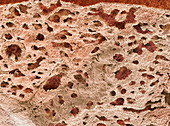 Lung alveoli,SEM